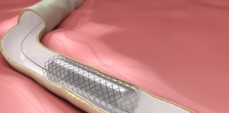 New technology can help improve various materials implanted into the human body – News-Medical.Net