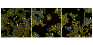 A technique called Cell Painting could speed drug discovery