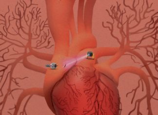 Medical microrobots that can travel inside your body are (still) on their way