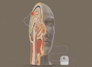 Beyond Neuralink: Meet the other companies developing brain-computer interfaces