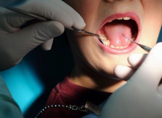 How the tiny microbes in your mouth could be putting your health at risk
