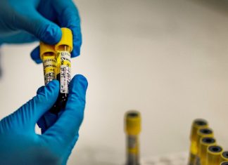 HIV could infect 1,400 infants every day because of US aid disruptions
