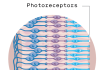 This implant can restore sight for patients with macular degeneration