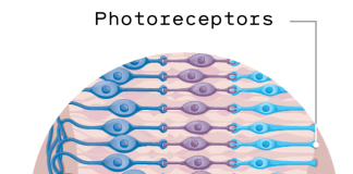 This implant can restore sight for patients with macular degeneration