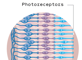 This implant can restore sight for patients with macular degeneration